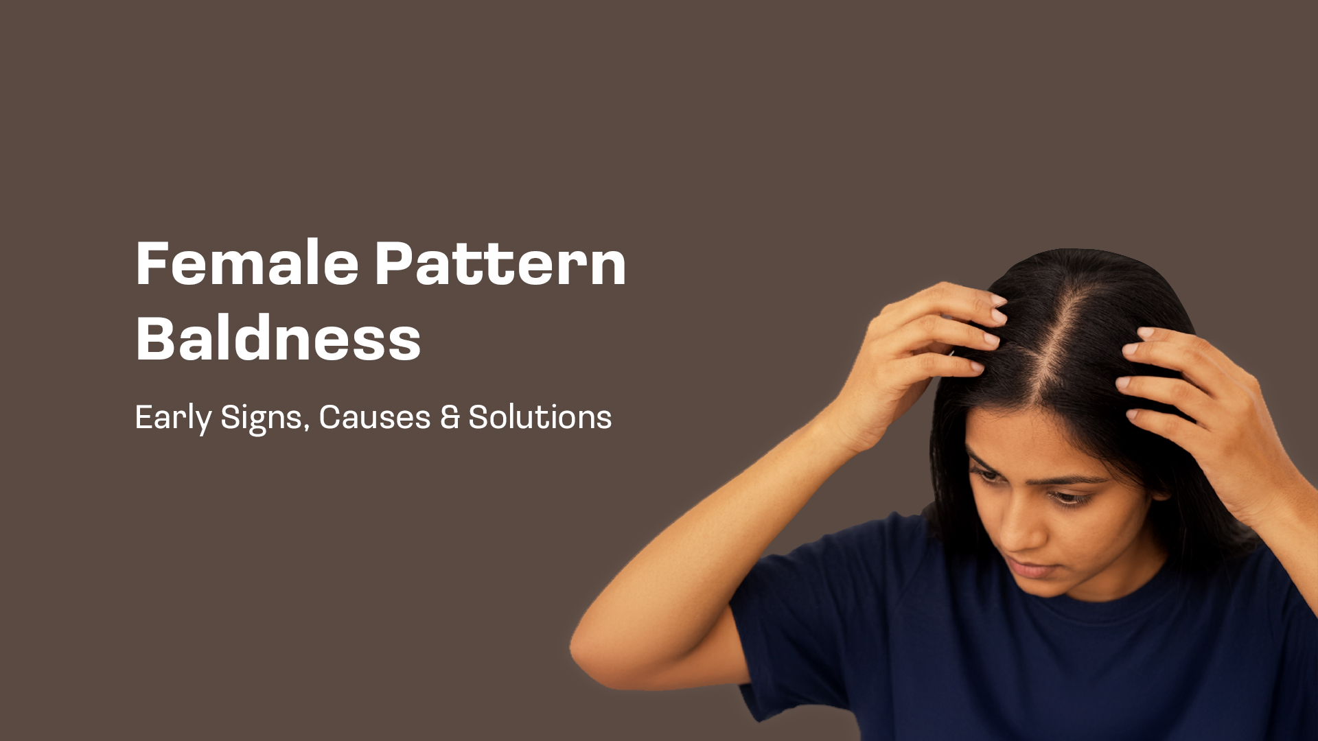Female Pattern Baldness